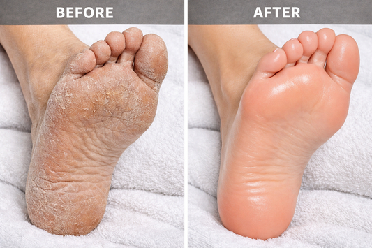 Special Foot Care Cream